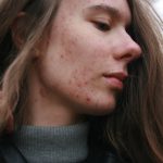 Histamine